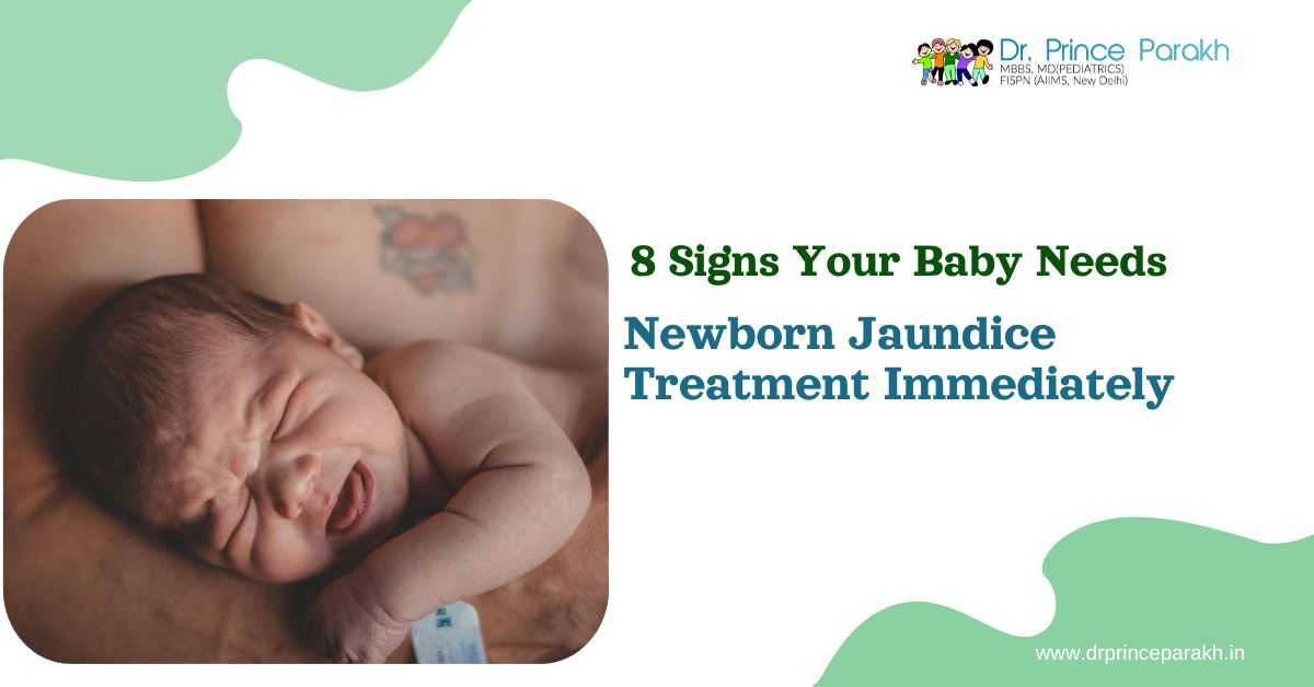 8 Signs Your Baby Needs Newborn Jaundice Treatment Immediately